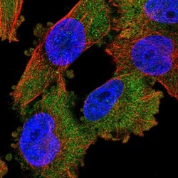 PKC iota Antibody, Novus Biologicals 0.1mL; Unlabeled:Antibodies, Polyclonal